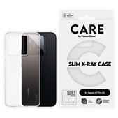 Ovitek X-Ray za Xiaomi 15T Pro 5G, transparent, CARE